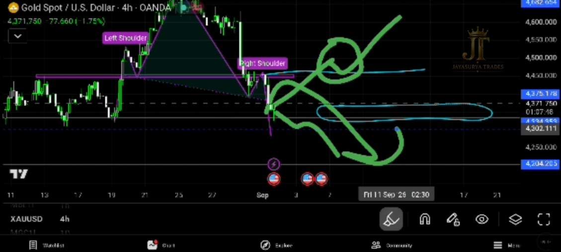 XAUUSD Gold Market Analysis September 1 2026 Key Decision Zone and Scenarios