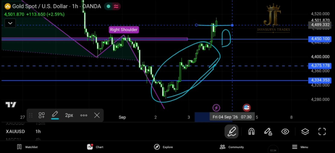 XAUUSD Gold Market Analysis September 3 2026 Chart 1